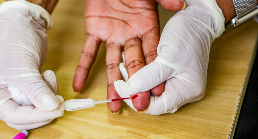 Prefeitura de Itapevi oferece testes rápidos para detectar HIV e ISTs