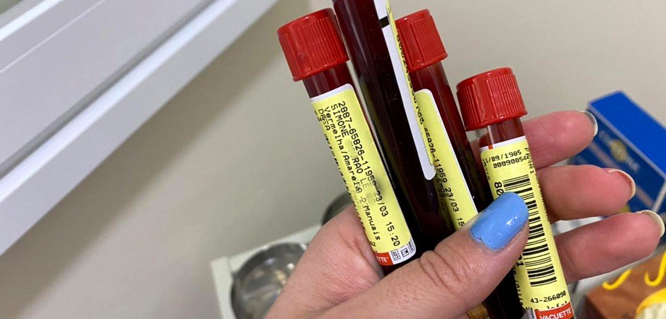 Cidade de São Paulo registra primeiro caso positivo para a variante Delta